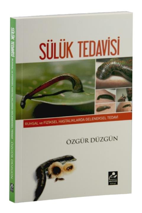 Mercan Kitap Ruhsal Ve Fiziksel Hastalıklarda Geleneksel Tedavi - Sülük Tedavisi - Özgür Düzgün 9786054908240