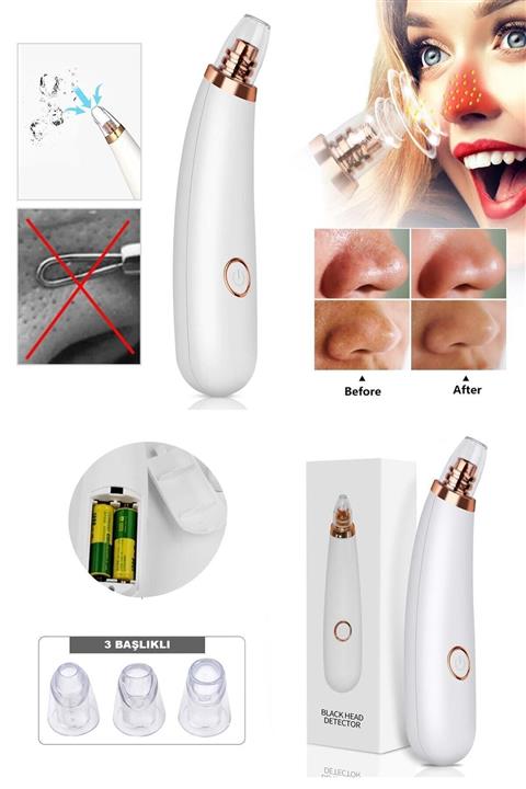 xolo 3 Başlıklı Pore Cleaner Vakumlu Siyah Nokta Dedektörü Cilt Peeling Pilli