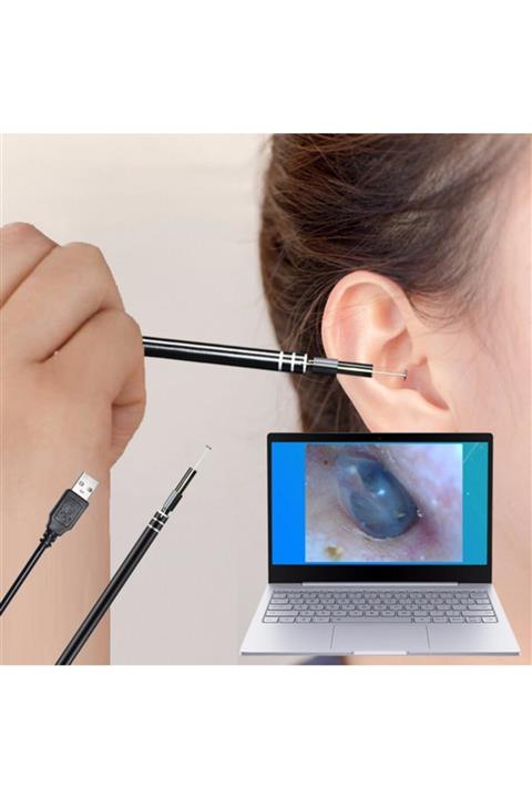 pengheng Kulak Temizleme Aracı Kaşık Hd Kamera Aracı Usb Tipi C Soket Win & Android