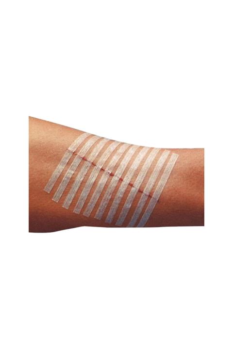 3M Steri-strip Dikiş Bandı 6mm X 100mm R1546 5poşet