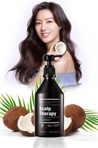 Missha Dökülme Karşıtı Saç Derisi Bakımı Yapan Bitkisel Şampuan (400ml) Scalp Therapy Shampoo