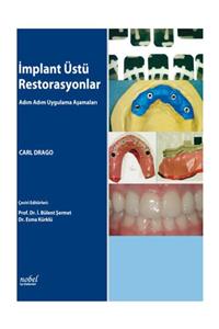 Dünya Tıp Kitabevi Implant Üstü Restorasyonlar