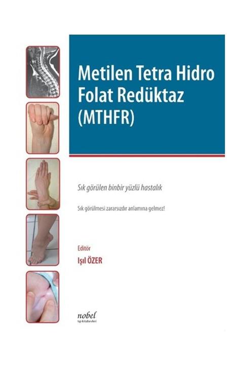 Nobel Tıp Kitabevi Metilen Tetra Hidro Folat Redüktaz (MTHFR)