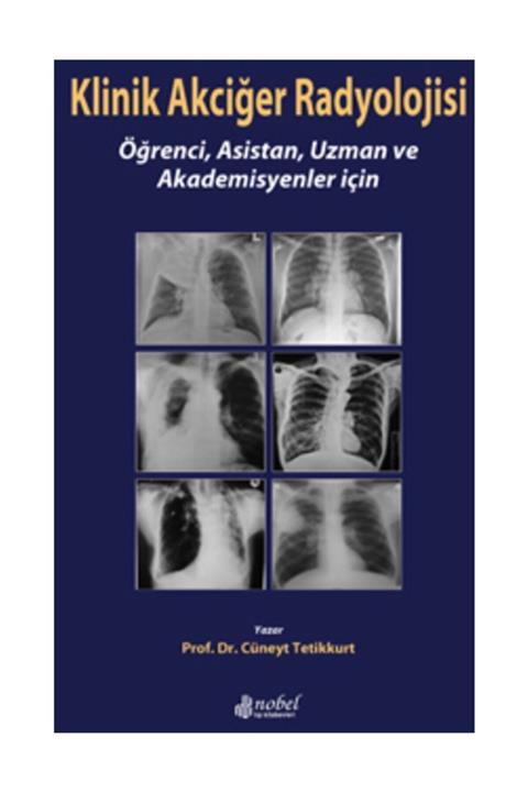 Nobel Tıp Kitabevi Klinik Akciğer Radyolojisi