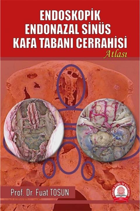 Ankara Nobel Tıp Kitapevleri Endoskopik Endonazal Sinüs Kafa Tabanı Cerrahisi