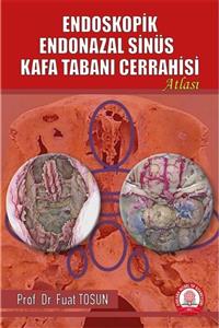 Ankara Nobel Tıp Kitapevleri Endoskopik Endonazal Sinüs Kafa Tabanı Cerrahisi