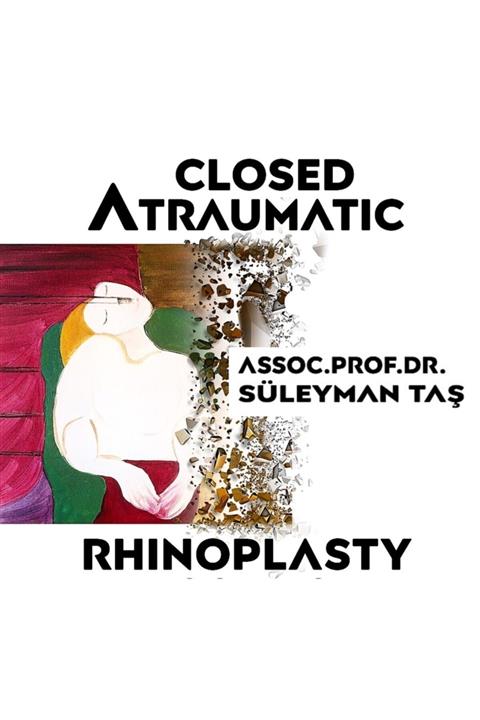 Doç. Dr. Süleyman TAŞ Kapalı Atravmatik Rinoplasti Canlı Cerrahi Dvd