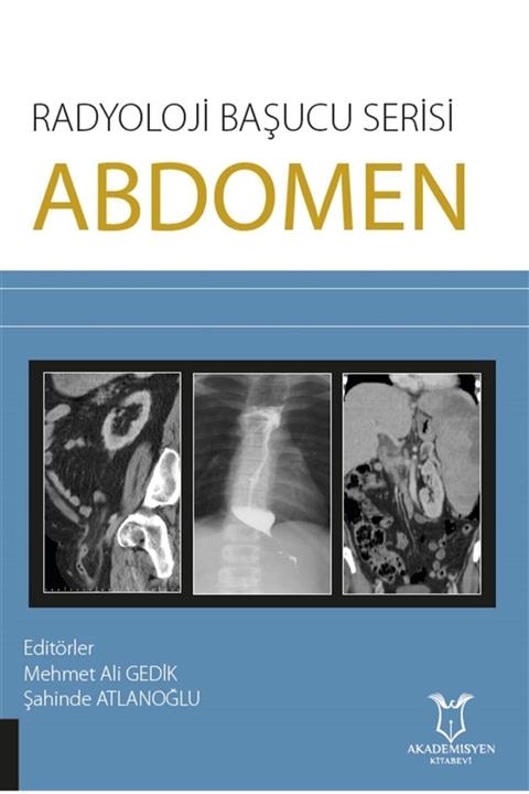 Akademisyen Kitabevi Abdomen - Radyoloji Başucu Serisi - Mehmet Ali Gedik 9786257275286