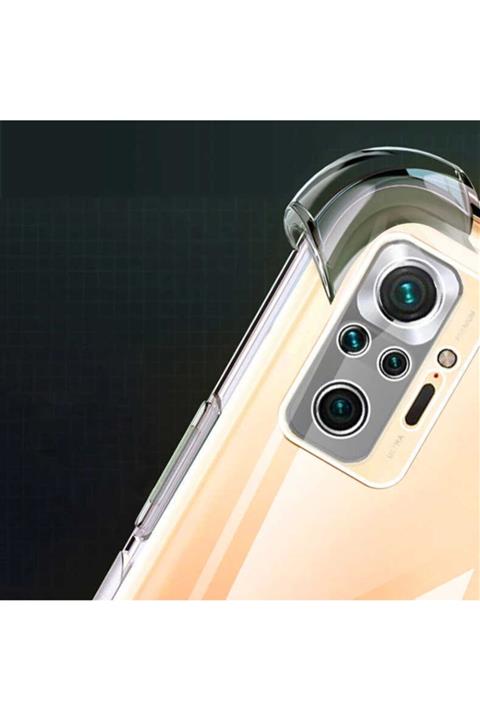 Xiaomi Cover Statıon Redmi Note 10s Şeffaf Kılıf Kamera Korumalı Darbe Düşmelere Dayanıklı Airbag Kapak