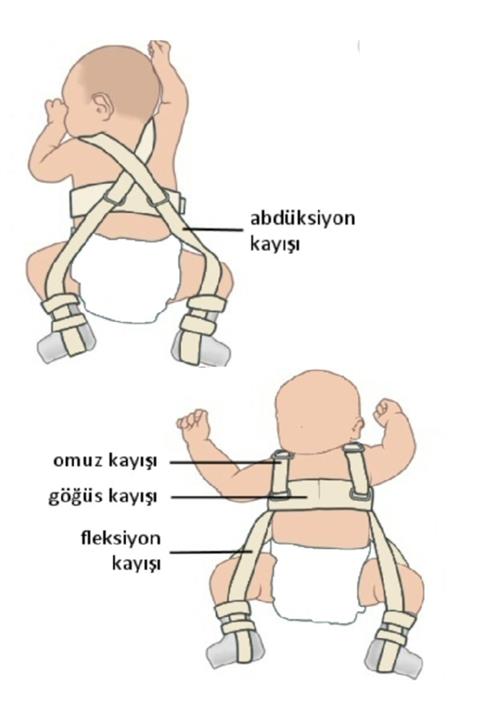 MEDİWAYS Pavlik Bandajı
