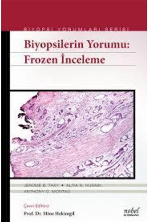 Nobel Tıp Kitabevi Biyopsilerin Yorumu:frozen Inceleme
