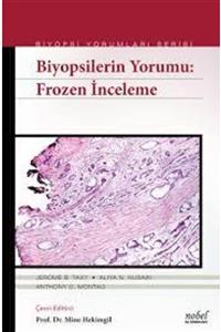 Nobel Tıp Kitabevi Biyopsilerin Yorumu:frozen Inceleme